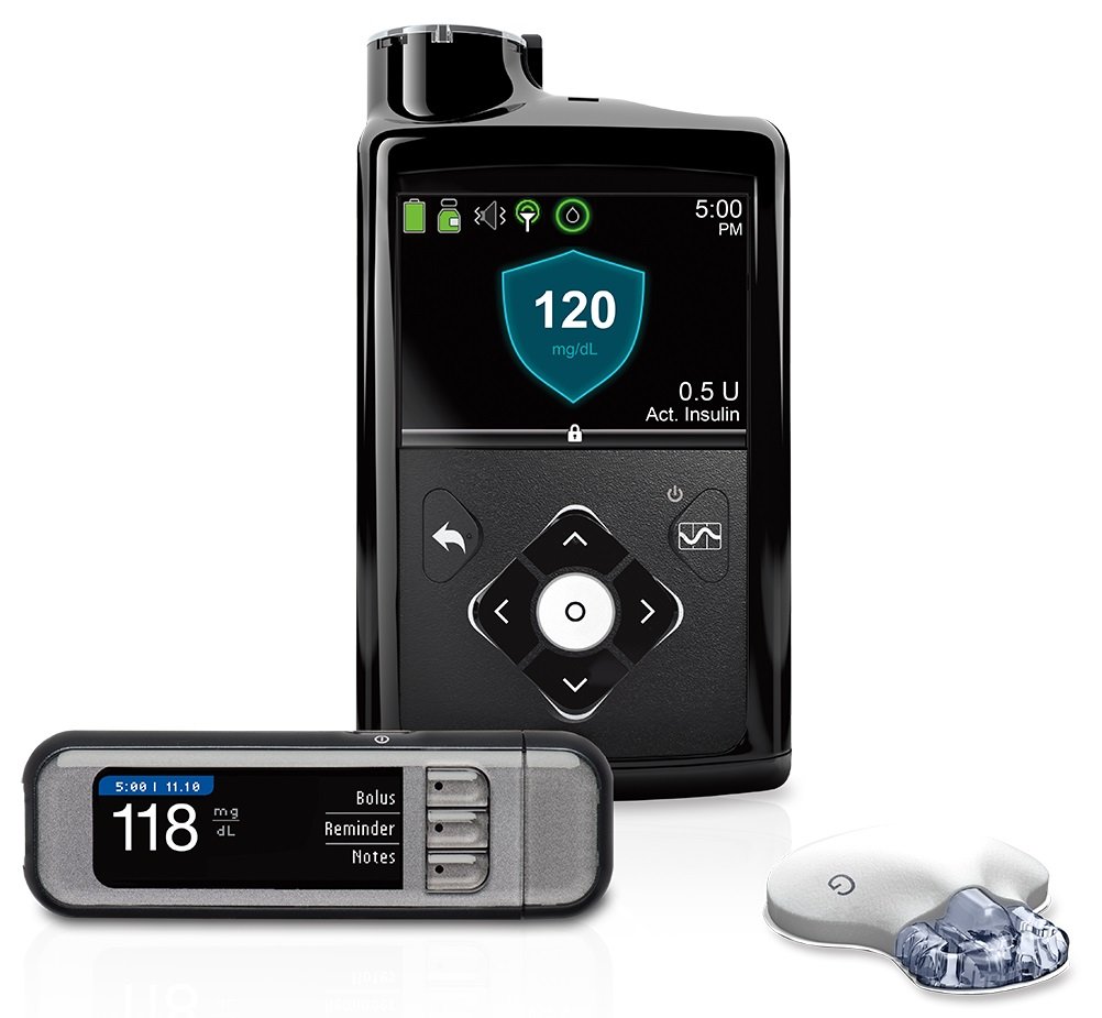 Medtronic 670G, das weltweit erste, kommerzielle Hybrid-Closed-Loop-System.