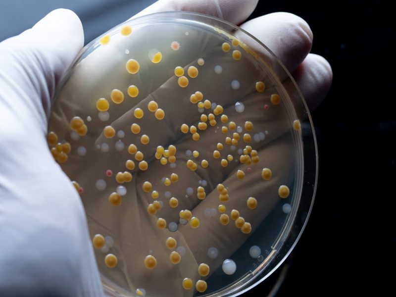 Eine Person mit einem weißen Handschuh hält eine bunte Bakterienkolonie in einer Petrischale.